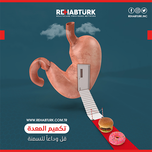 تكميم المعدة في تركيا